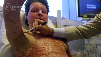 Transplante de rosto e mãos bem-sucedido