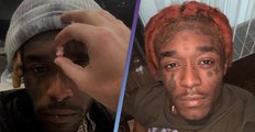 Lil Uzi Vert Has $24 Million Pink Diamond Implanted Into His Forehead