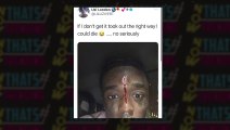 Lil Uzi Vert Could Die because his diamonds face implant he said on his twitter page