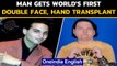 22-year-old New Jersey man gets world's first double face, hand transplant|Oneindia News