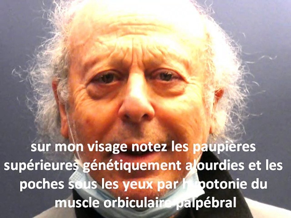 regard sombre, cernes  et paupières lourdes , explications   par vladimir mitz