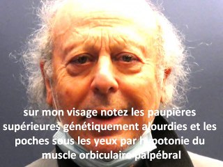 regard sombre, cernes  et paupières lourdes , explications   par vladimir mitz
