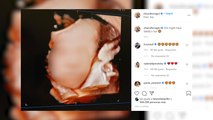 Chiara Ferragni recuerda el nacimiento de su hijo, 