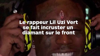 Un rappeur se fait incruster un diamant au milieu du front