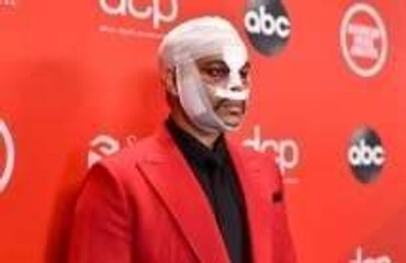 The Weeknd revela el motivo detrás de su transformación facial