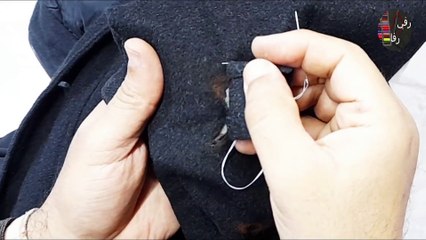 Biggest burn from cigarettes in a woolen jacket.