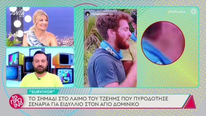 Survivor: Το σημάδι στο λαιμό του Τζέιμς που πυροδότησε τις φήμες για ειδύλλιο!