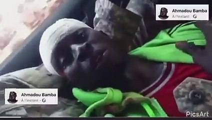 Les premiers mots du partisan d'Ousmane Sonko blessé à la tête