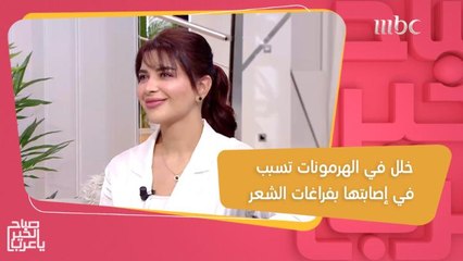خلل في الهرمونات تسبب في معاناتها من فراغات الشعر.. وأخيراً تخلصت من المشكلة!