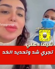 شيماء علي تخضع لتقنية لشد الوجه وتجميل الخدين