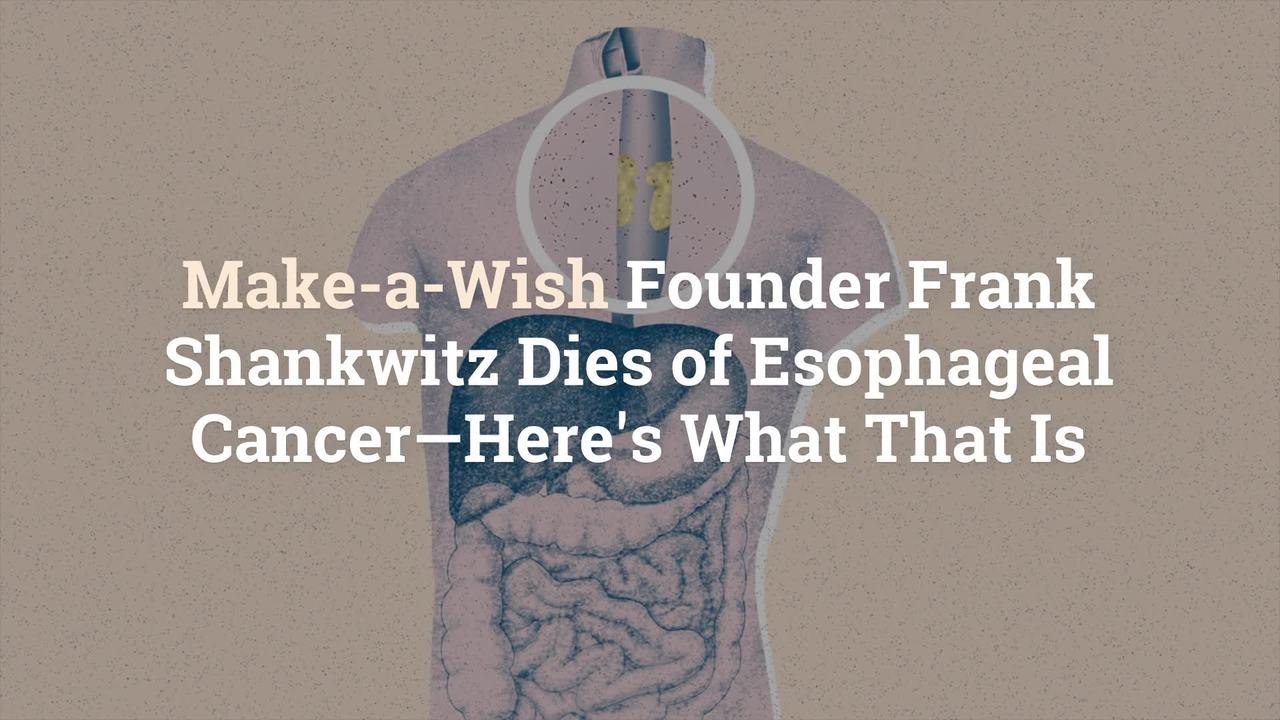 Make-a-Wish Founder Frank Shankwitz Dies of Esophageal Cancer—Here's What That Is