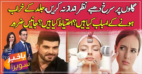 Don't ignore red spots on the cheeks, What are the causes and precautions? Watch video