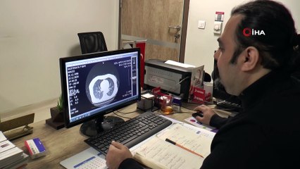 Korona virüsü geçirdikten sonra sağlık kontrolleri önemli