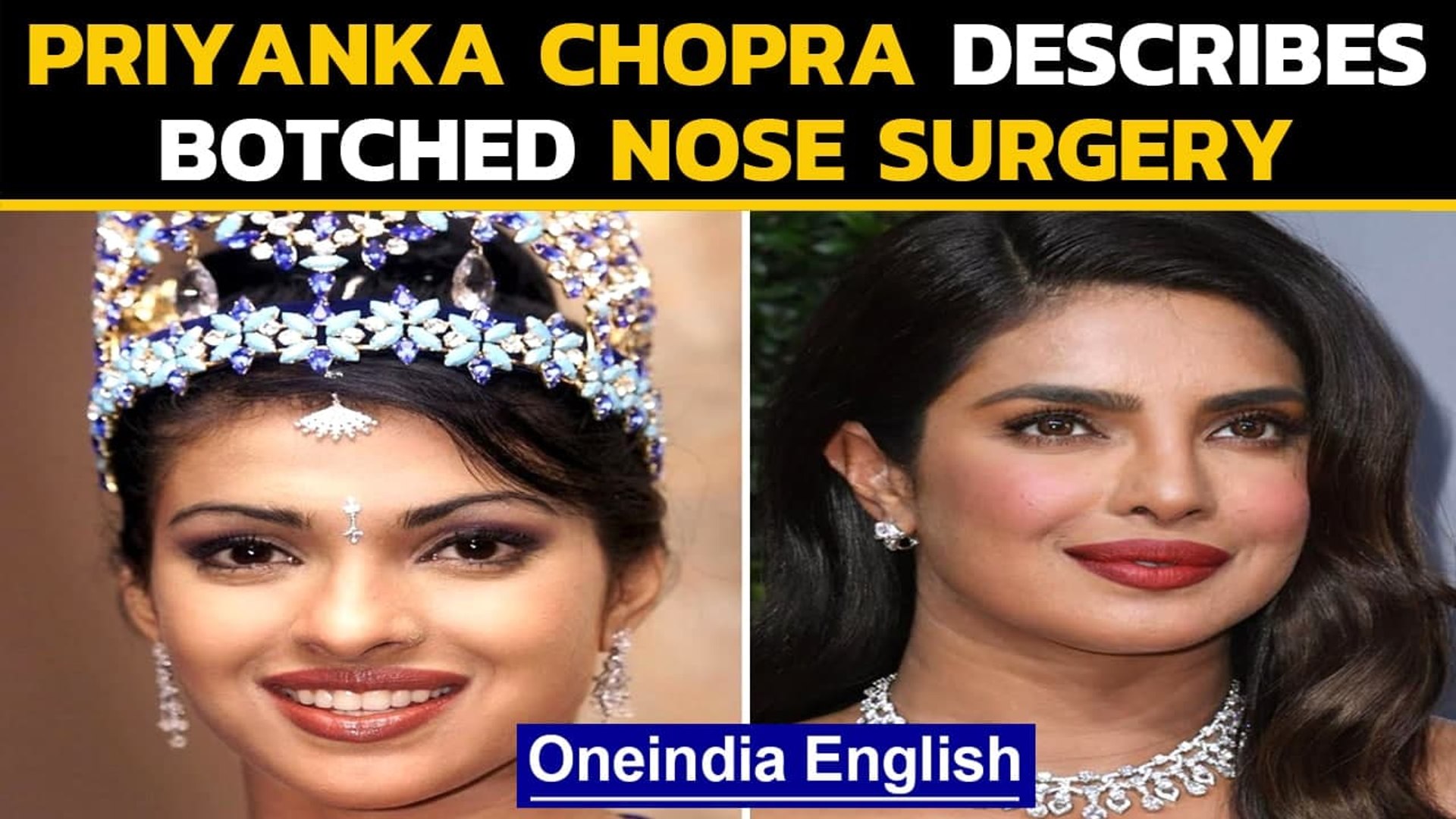 priyanka chopra nose job Image 5