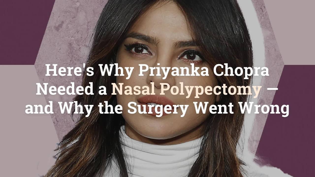 Here's Why Priyanka Chopra Needed a Nasal Polypectomy—and Why the Surgery  Went Wrong - video Dailymotion