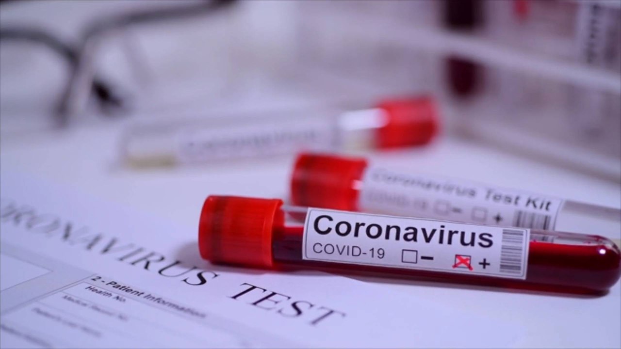 If You Have Covid-19, How Can You Care For Yourself?