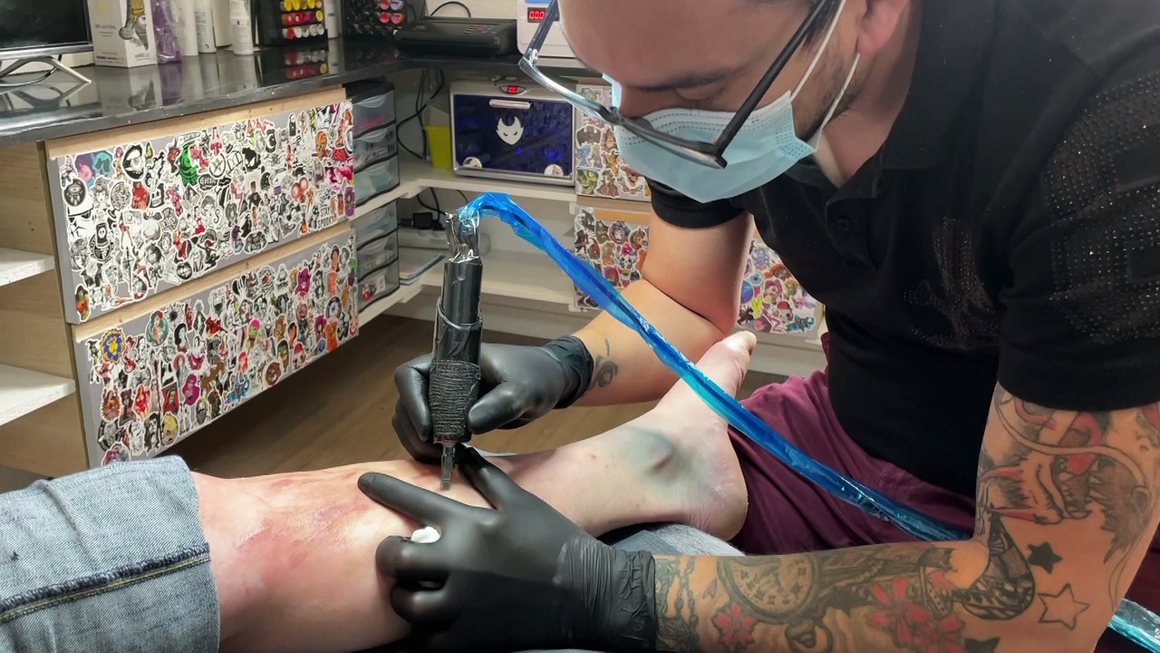 Il réduit les cicatrices physiques et psychologiques