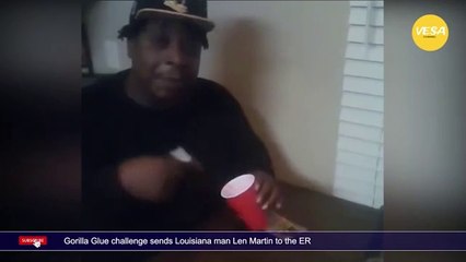 Gorilla Glue challenge sends Louisiana man Len Martin to the ER