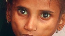 Half of Yemeni children under 5 face acute malnutrition: UN