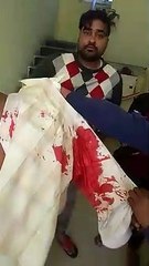 प्रयागराज: केश ले जा रहे यमुनापार टोल प्लाजा के अकाउटेन्ट को बदमाशों ने मारी गोली