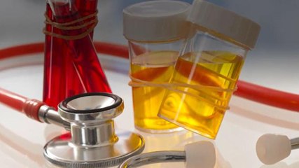 اليوم العالمي للسكري 🌍