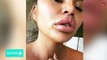 Chrissy Teigen Shares Nude Selfie Of Her Surgical Scars