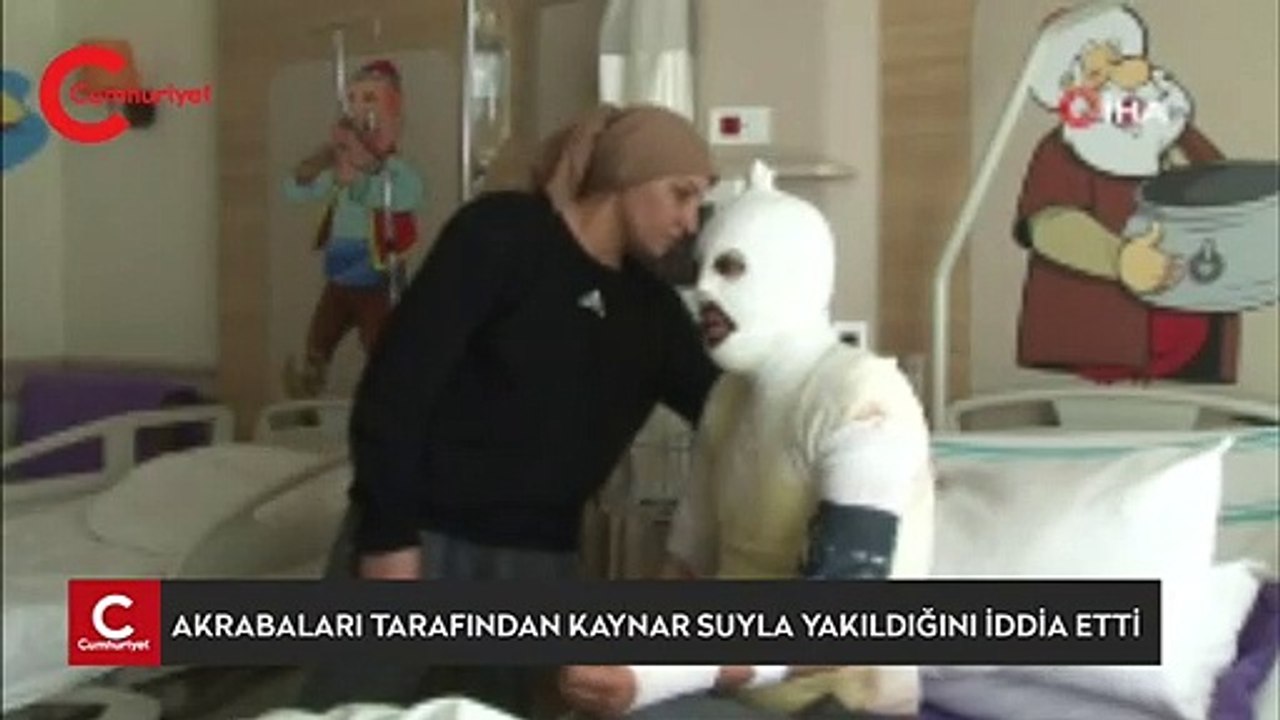 Akrabaları tarafından kaynar suyla yakıldığını iddia etti