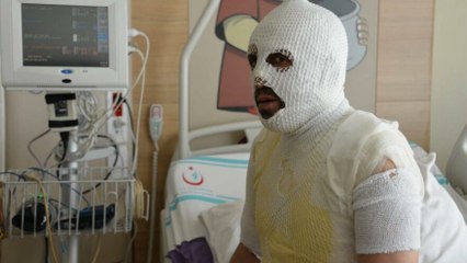 Akrabaları tarafından kaynar suyla yakıldığını iddia etti