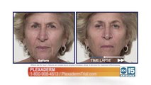 Get rid of undereye bags and wrinkles in just 10-minutes with Plexaderm