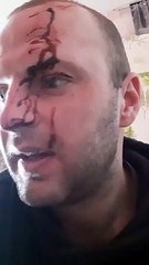 Kraujoto viro Tiesiogine transliacije