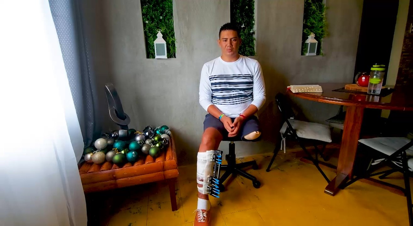 mqn-joven-protesis-180221