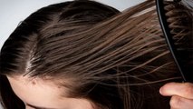 1 दिन मे ही Oily हो जाते हैं Hair, तो बस हर रोज कर लें ये काम | Tips for Oily Skin | Boldsky
