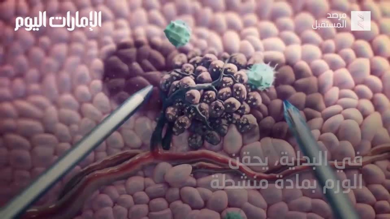بالفيديو.. لقاح للسرطان يثبت فعاليته بشفاء أول 3 مرضى
