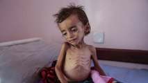 الأمم المتحدة: 12 مليون يمني بحاجة ماسة للمساعدة