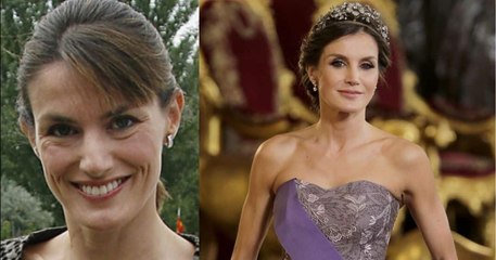 Las cirugías de la Reina Letizia: rinoplastia, mentoplastia, bichectomía y otros secretos