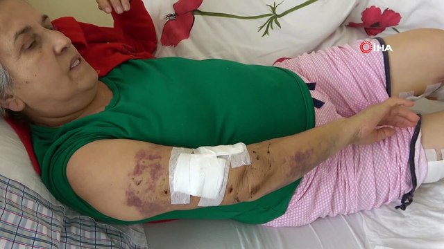 Sokak köpeklerinin saldırısına uğrayan yaşlı kadın ölümden döndü