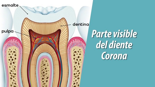 Consejos dentales | Endodoncia - Nex Panamá