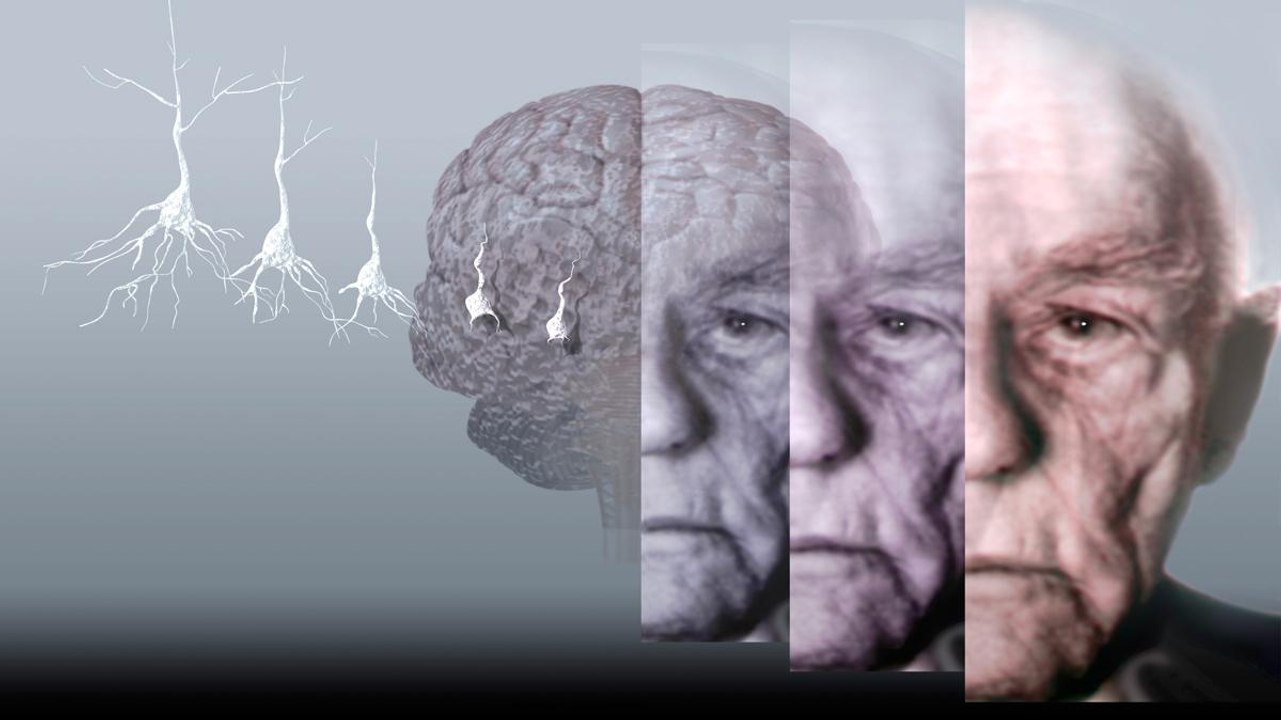 Sleep Well To Avoid Alzheimer’s