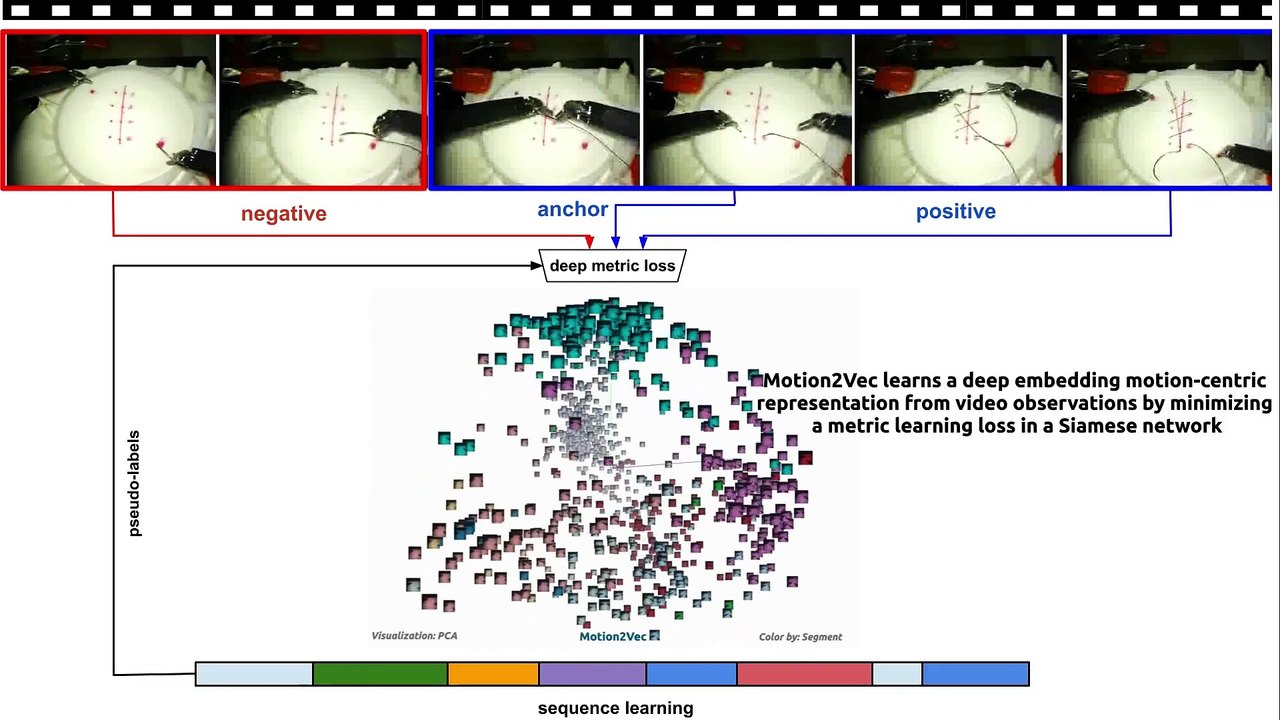Motion2Vec- semi-supervised representation learning from surgical videos