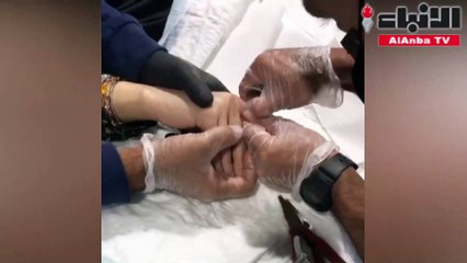 رجال الإطفاء تمكنوا من تخليص امرأة من خاتم محشور