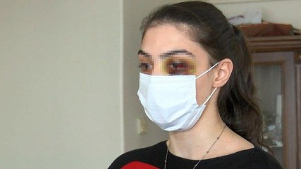 Video izlediği için feci şekilde dövülen kadın: Ölmeyi mi bekleyeyim?