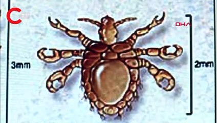 "Dirençli uyuz vakalarında" patlama! 15 dakikada bulaşıyor