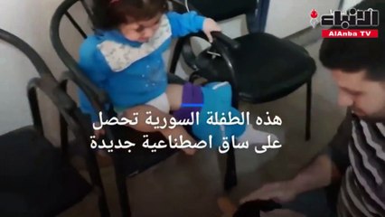 طفلة ساق صناعية