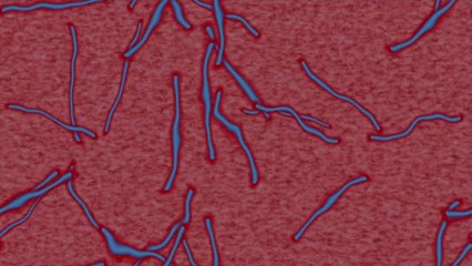 CDC Implements Travel Restrictions for Countries With Ebola Cases