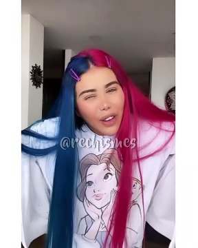 Yina Calderón dio detalles de su próxima cirugía