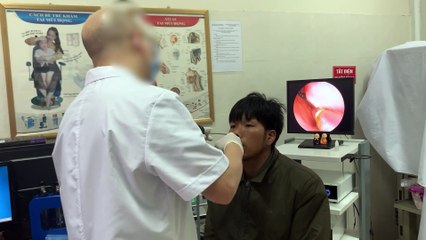 Doctor Removes Slithering Parasite from Man's Nose
