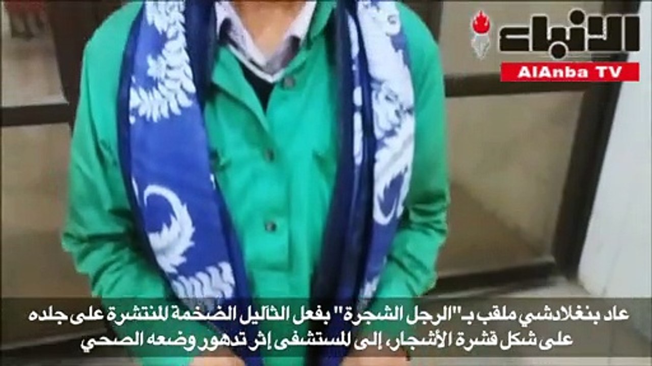 الرجل الشجرة يعود إلى المستشفى في بنغلادش بعد تدهور وضعه الصحي