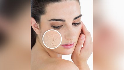 ड्राई स्किन की होगी छुट्टी और चेहरा भी करेगा ग्लो बस अपनाए ये घरेलु तरीका । Dry Skin Care । Boldsky