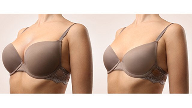 स्तन का आकार कम करने का जबरदस्त तरीका | Stan Aakar Kam Karne Ka Jabardast Tarika | Boldsky