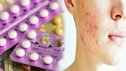 Contraceptive Pills बिगाड़ सकती हैं आपका चेहरा, हो सकता है Skin Infection | Boldsky